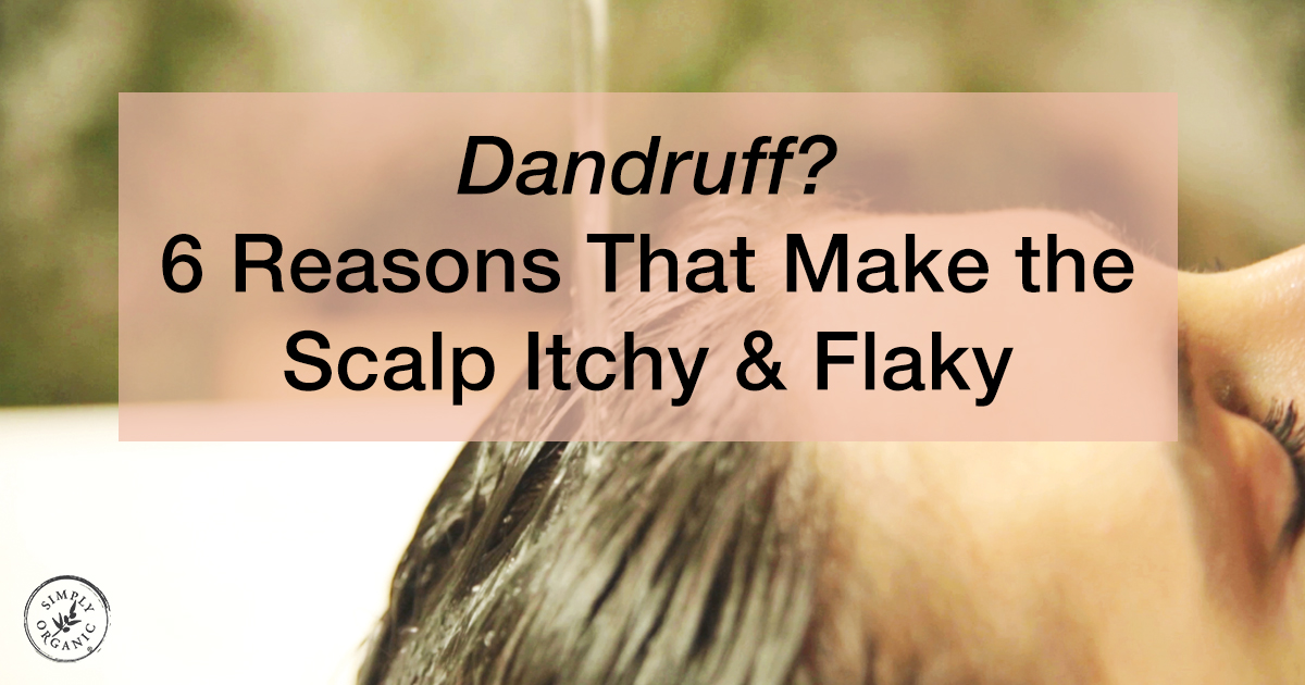 dandruff flakes in hair