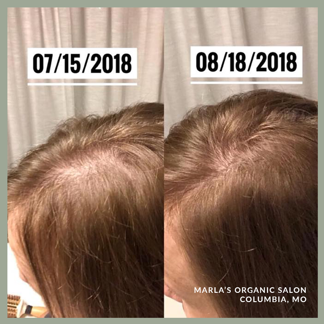 oway-scalp-treatments-results